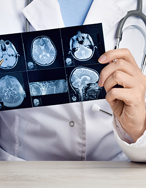 Best Neurology Hospital In Indore - Brain Hospital & Neurologist 